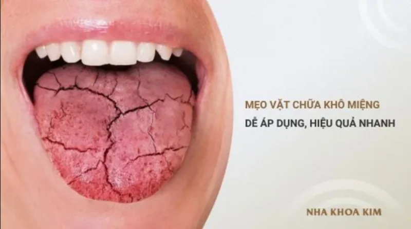 Hiểu đúng nguyên nhân giúp bạn chọn cách cải thiện khô miệng phù hợp và an toàn hơn.
