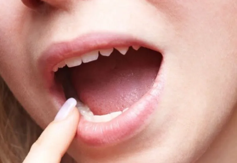 Mẹo vặt chữa khô miệng giúp hơi thở dễ chịu và ăn ngon hơn